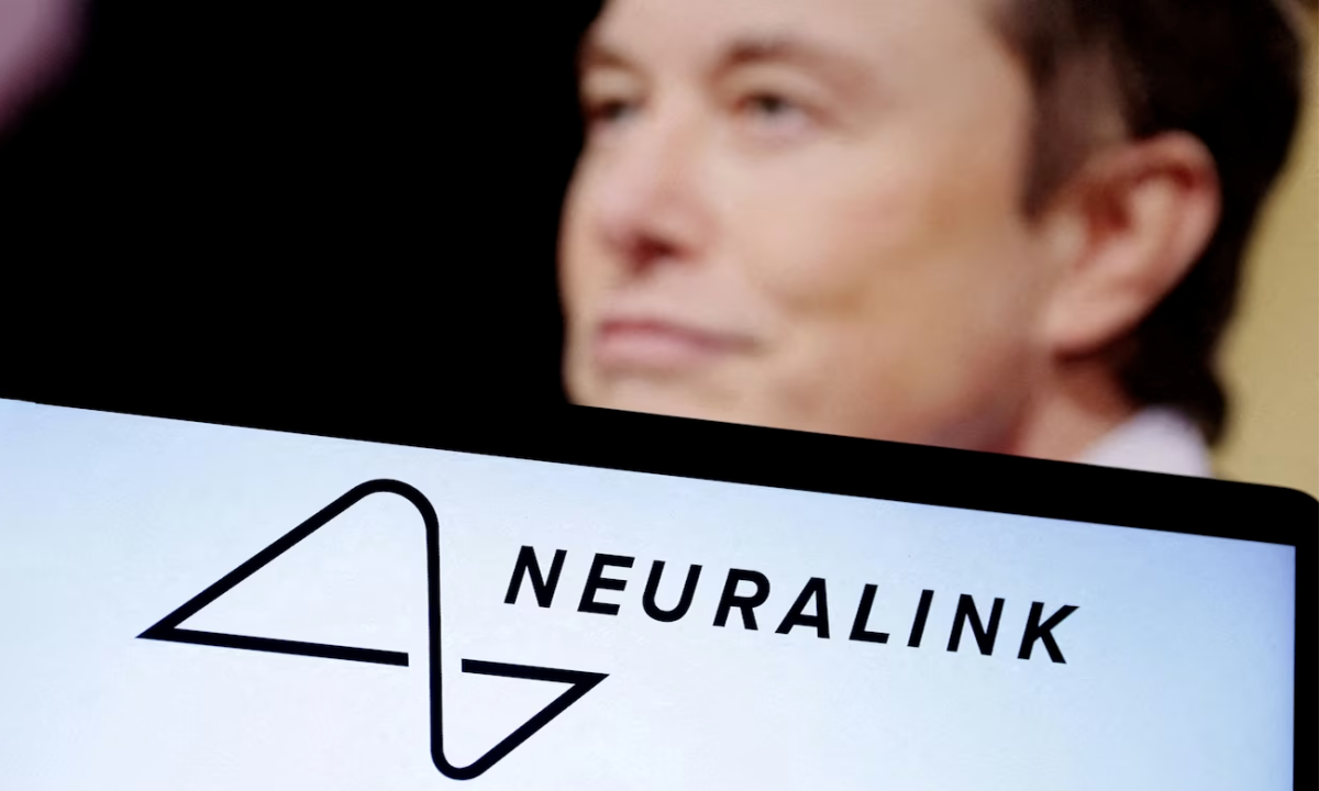Công ty của Musk bắt đầu thử nghiệm cấy chip lên não người