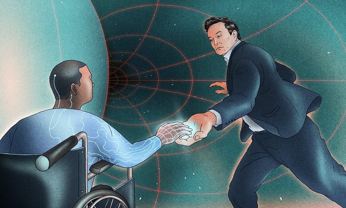 Elon Musk: Người cấy chip não có thể di chuột bằng ý nghĩ